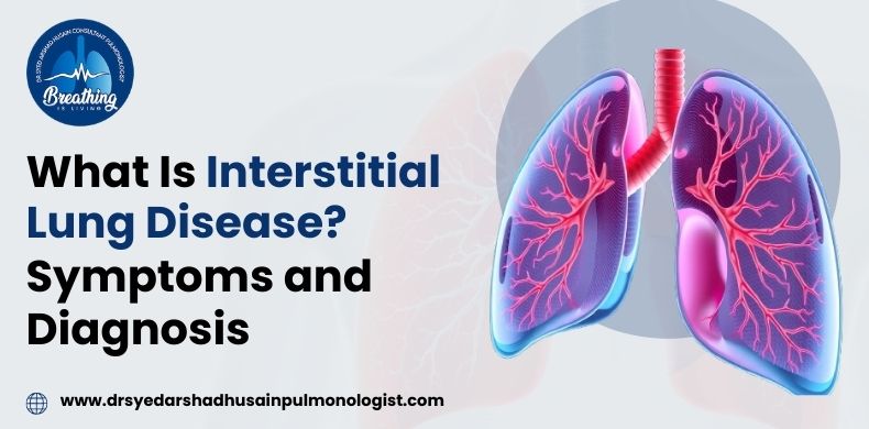 What Is Interstitial Lung Disease_ Symptoms and Diagnosis