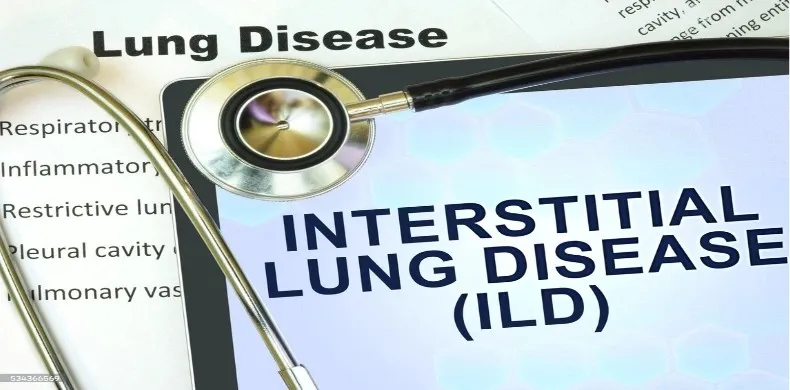 How to Recognize the Signs of Interstitial Lung Disease (ILD)?