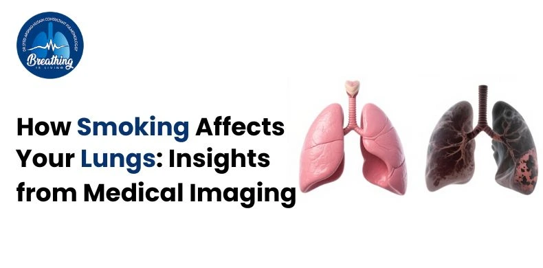 How Smoking Affects Your Lungs: Insights from Medical Imaging