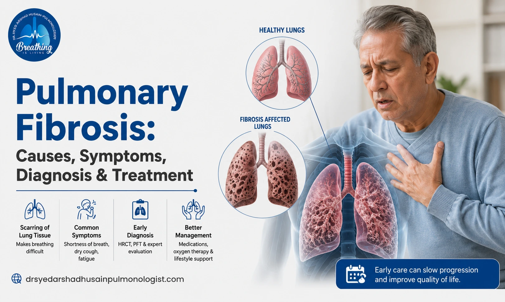 Pulmonary Fibrosis: Symptoms, Causes & Treatment