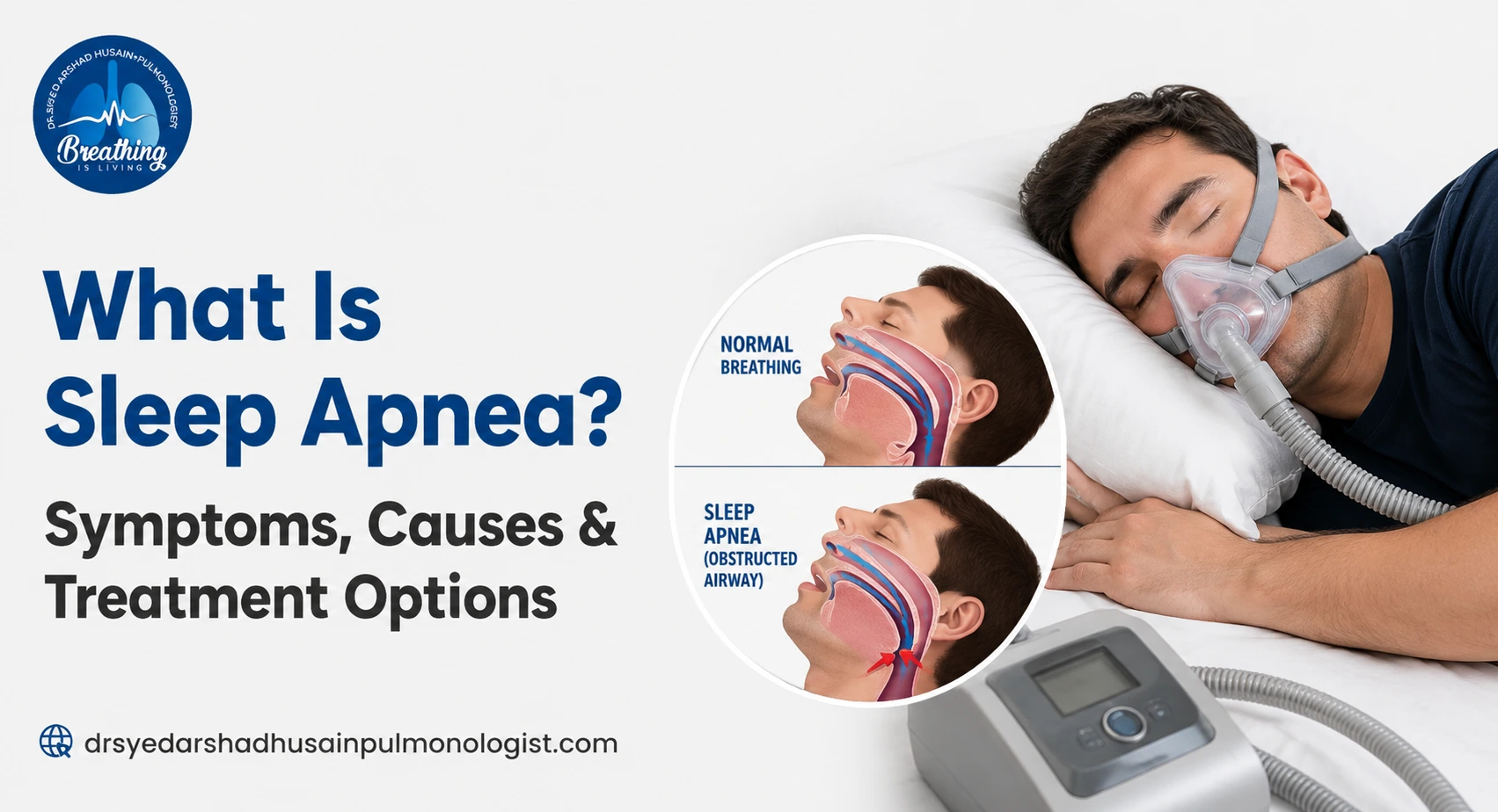 What Is Sleep Apnea? Here's What's Really Happening While You Sleep