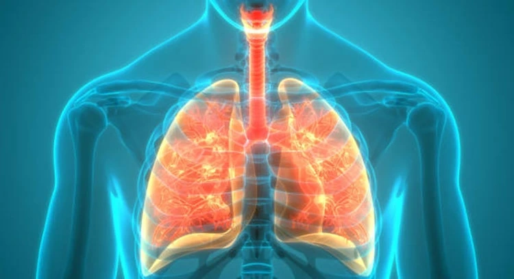 Allergic Asthma