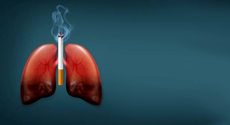 Smoking Related Lung Diseases
