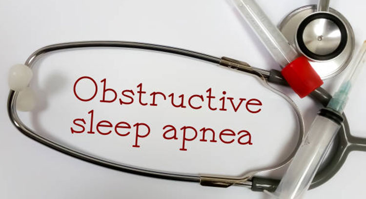 Obstructive Sleep Apnea Syndrome (OSAS) Treatment: Prof. Dr Husain