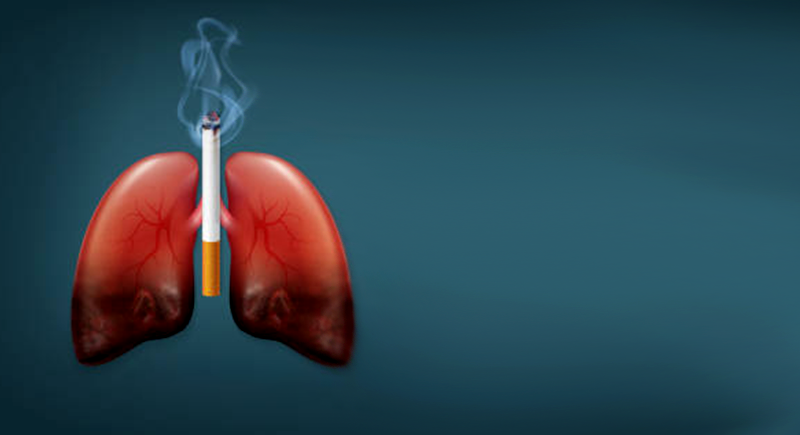 Smoking Related Lung Diseases