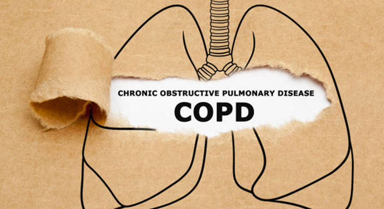 COPD/Emphysema clinic