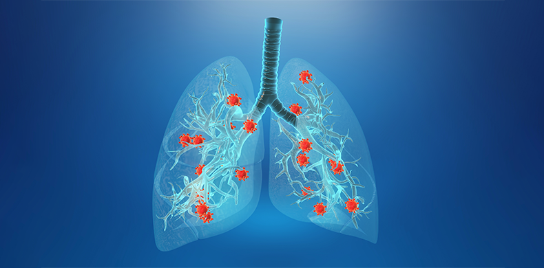 Respiratory Infections Causes