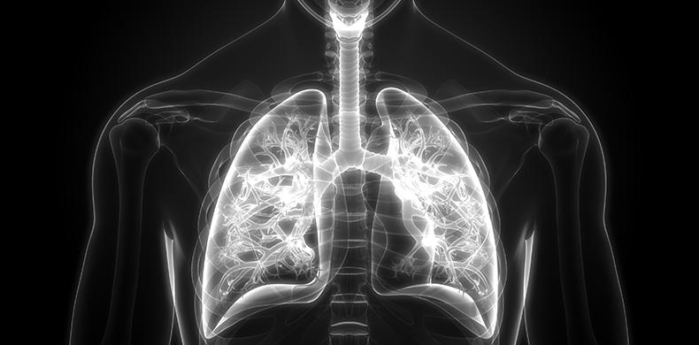 Respiratory Infections Xray