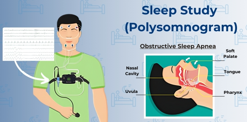 Sleep Study (Polysomnogram)