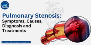 pulmonary stenosis symptoms, causes, diagnosis and treatments