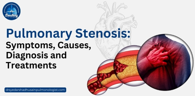 pulmonary stenosis symptoms, causes, diagnosis and treatments