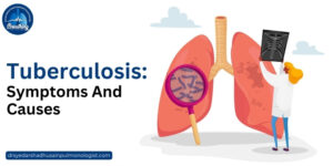 tuberculosis symptoms and causes