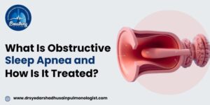 What Is Obstructive Sleep Apnea and How Is It Treated